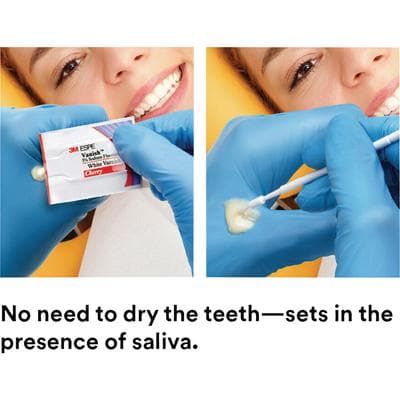 3M Vanish 5% Sodium Fluoride White Varnish with TCP, Mint, 0.5 mL Unit Dose, 100/Pk, 12150M thumbnail 27