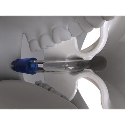 Pivatool Aerosol Assist Hands-Free Aerosol Suppression Device Kit, White, 6 Devices, Standard HVE Connection thumbnail 3