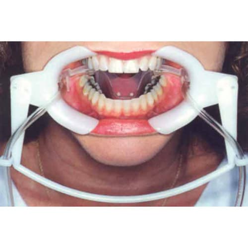 Nola Dry Field System, Large, White, Full Arch Isolation with Silicone Tubing, 300-401 thumbnail 4
