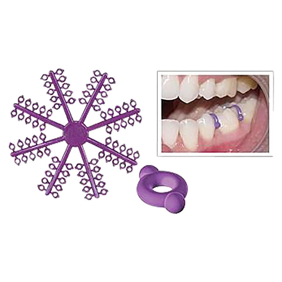 Ortho Elast-O-Loop2 Separators, Purple, 960/Pack, 480-300 - Ortho - Elast-O-Loop2 Separators - Image 1
