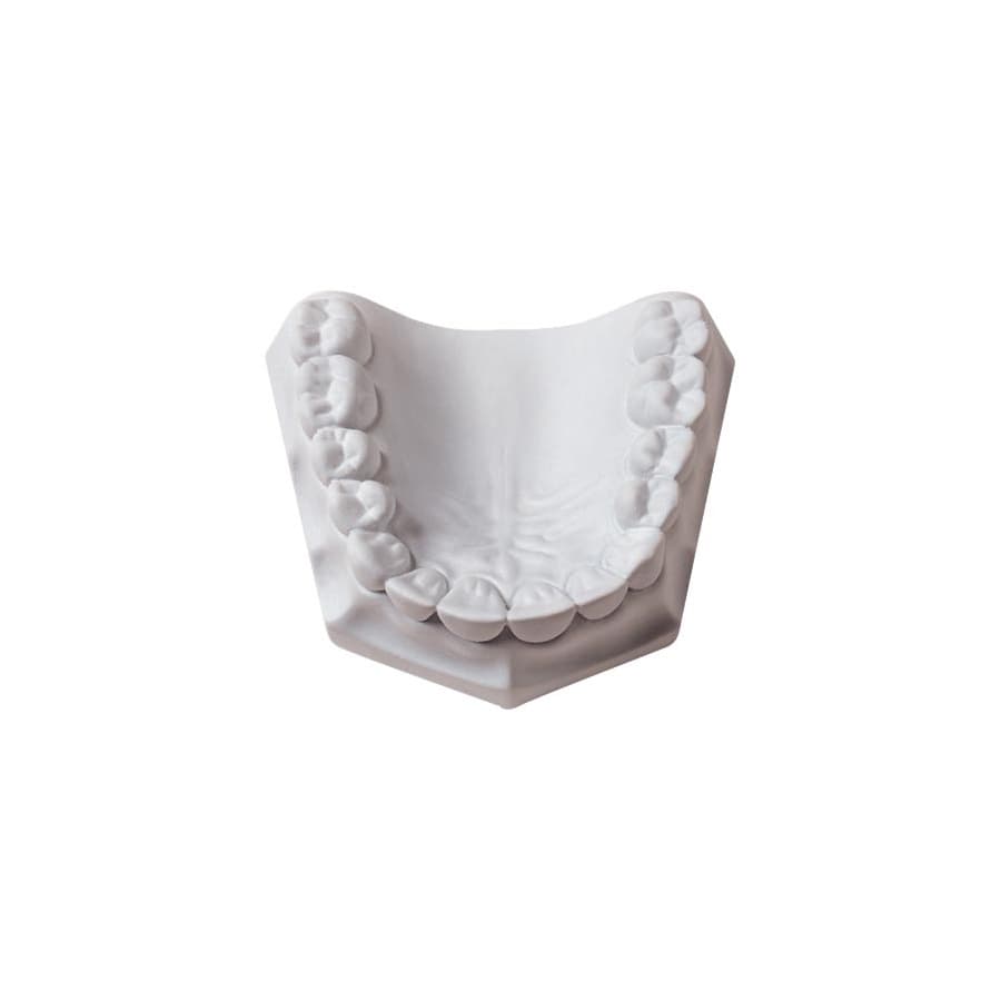Whip Mix Mounting Plaster, Pre-weighed 100g Envelopes, Fast Set, White, 100/Pack, #15550 thumbnail 5