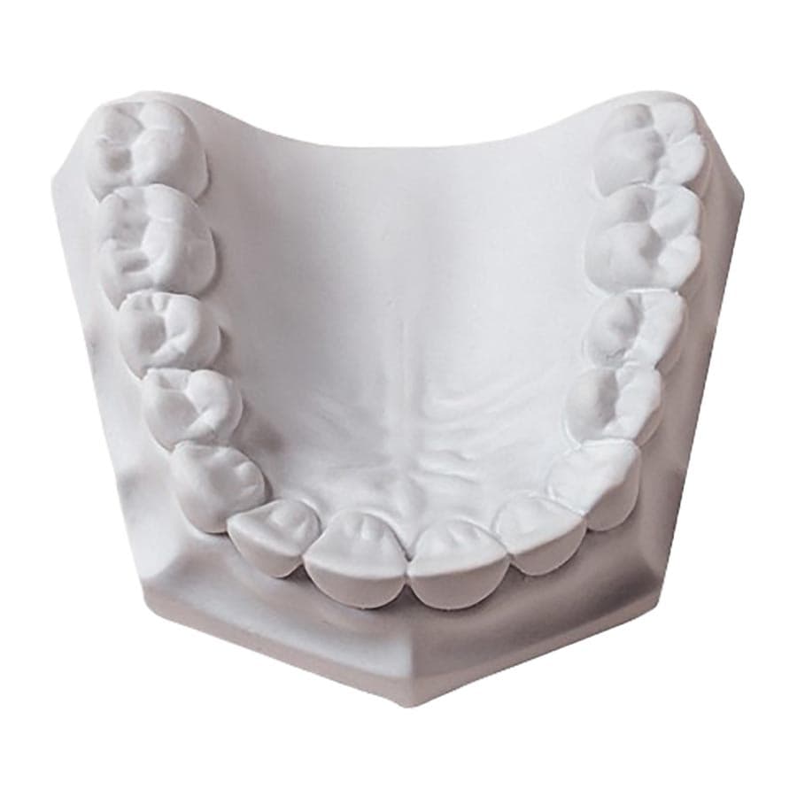 Whip Mix Mounting Plaster, White, Fast Set, ISO Type 1, 33 lb Carton (15 kg), #330090 thumbnail 5
