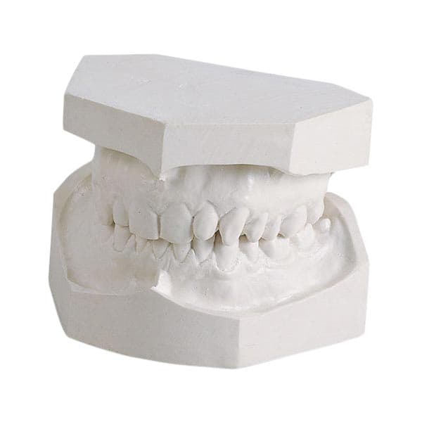 Kulzer Modern Materials O-67 Snow White Orthodontic Stone, Type III, 25 lb Box, 50046972 thumbnail 5