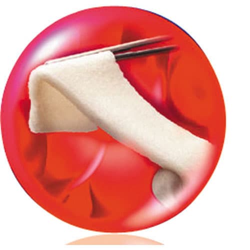 Ethicon Surgifoam Absorbable Gelatin Sponge, 1 cm x 1 cm x 1 cm, 24/Box, 1969 thumbnail 2