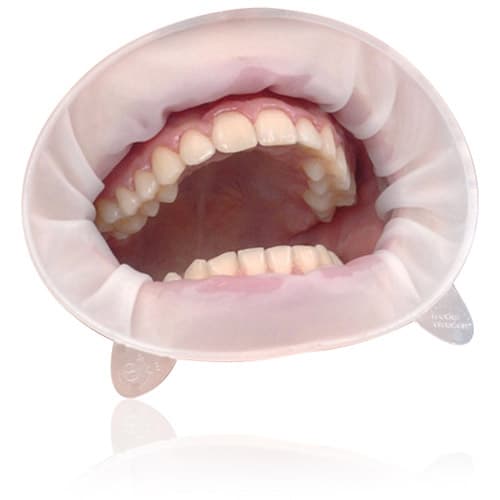 OptraGate ExtraSoft Lip and Cheek Retractor Refill, Junior, 80/Pkg, 591451WW thumbnail 9