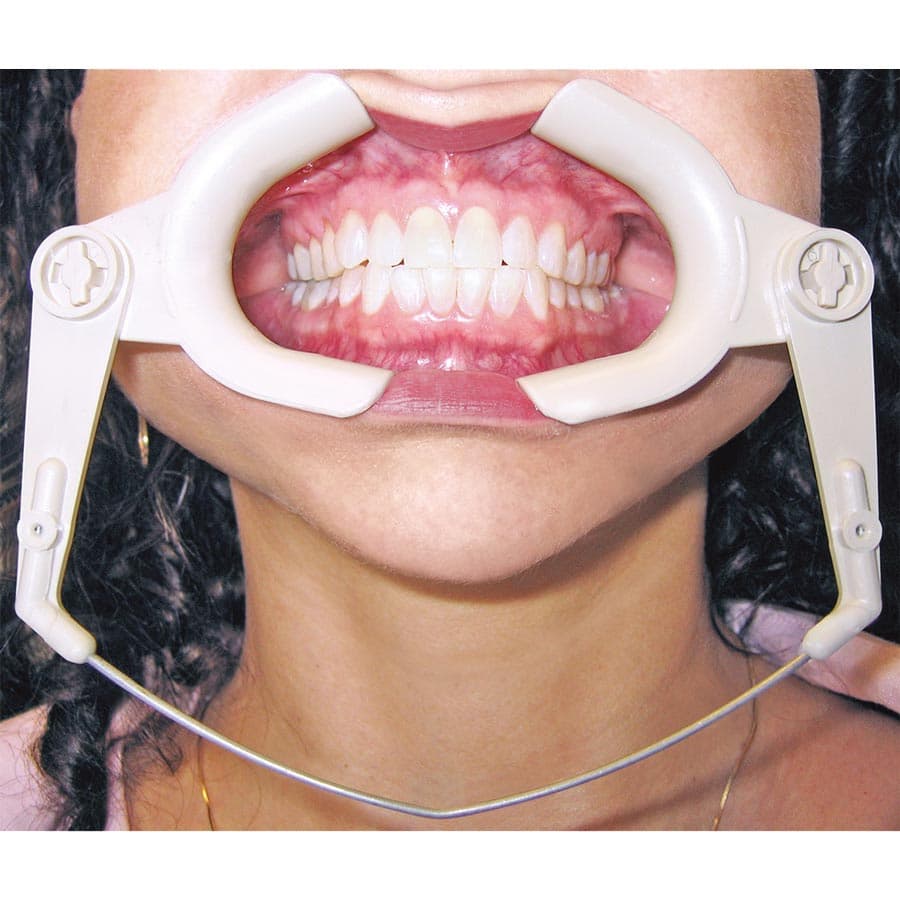 Ortho Cheek Retractor, Wire Type, 601-190 - Ortho - Cheek Retractors - Image 1