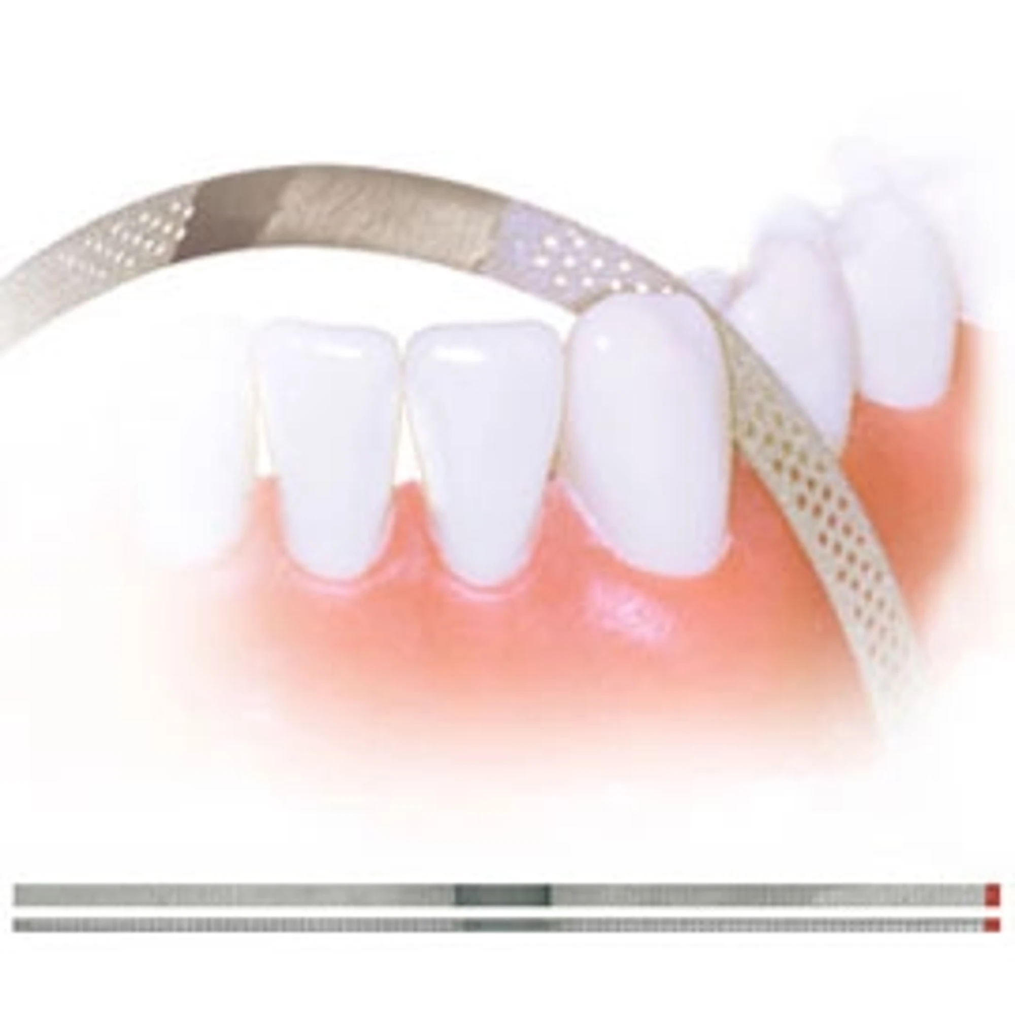 NTI Perforated Diamond Finishing Strips, Narrow, 2.5 mm, Superfine (Yellow), 10/Pk, FSP2-SF thumbnail 6