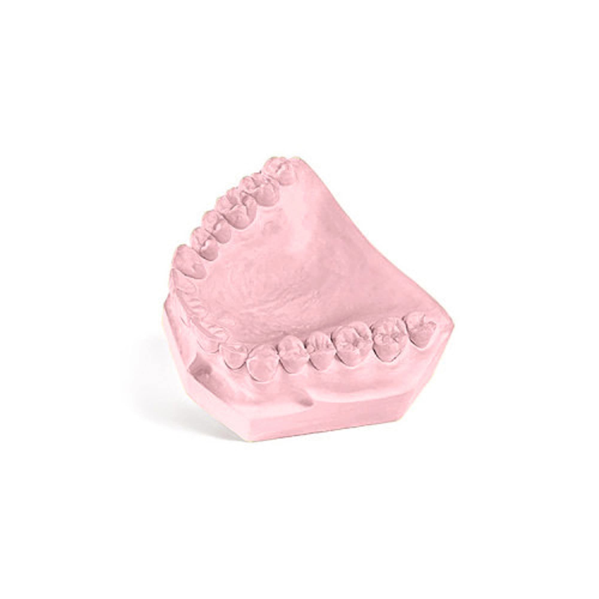 Garreco Express Set Pink Type IV Specialty Stone, 25 Lbs, 1285025 thumbnail 2