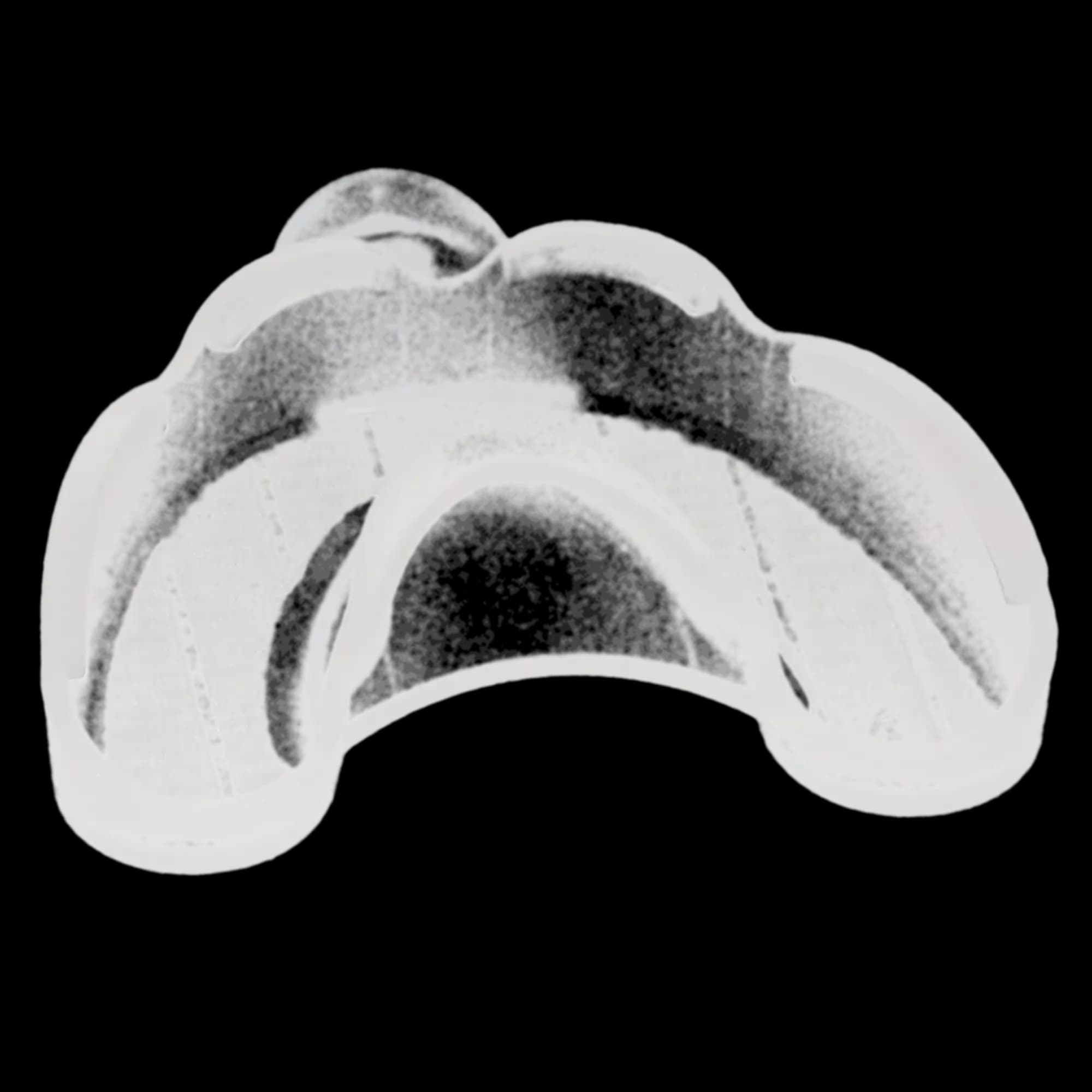 3M Directed Flow Disposable Impression Tray, Medium Upper, Refill, 10/Pk, 71616 thumbnail 3