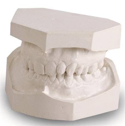 Kulzer O-67 Snow White Orthodontic Stone, Type III, 45 lb Box, 50046952 thumbnail 7