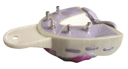 Miratray Implant Advanced Impression Tray, Upper S3 Large, 6/Pack, 101253 thumbnail 7