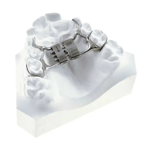 Leone America Fixed Rapid Palatal Expander, 15 mm, A0620-15 - Fixed Expansor, Rapid Palatal Expander, 15 mm, A0620-15 - Image 1