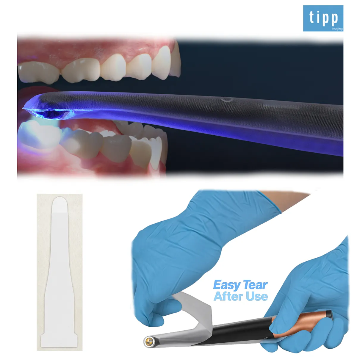 TIPP Imaging Curing Light Protection Sleeves, Size 2, Latex-Free, 100/Pkg - TIPP Imaging Curing Light Protection Sleeves – Size 2, 100/Pkg - TIPP Imaging Curing Light Protection Sleeves – Size 2, 100/Pkg - Image 1
