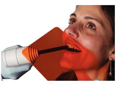 Premier Cure-Shield Handheld Visible Curing Light Shield, Orange, 3/Pk, 9006166 thumbnail 3
