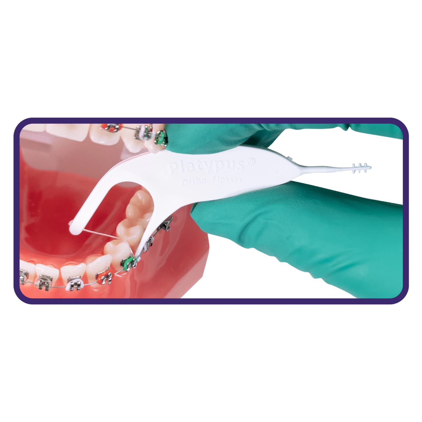 Platypus Orthodontic Flossers, No Threader Required, with Interdental Pick, 30/Bag, T130 thumbnail 9
