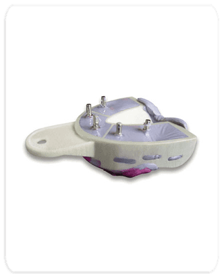 Miratray Implant Advanced Impression Tray, Lower L2 Medium, 6/Box, 101255 thumbnail 3