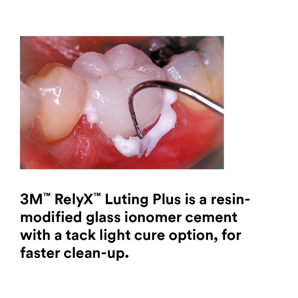 RelyX Luting Plus Automix Resin-Modified Glass Ionomer Cement Trial Kit, 8.5 g Syringe, 12 Mixing Tips, 1/Kit, 3535TK thumbnail 11