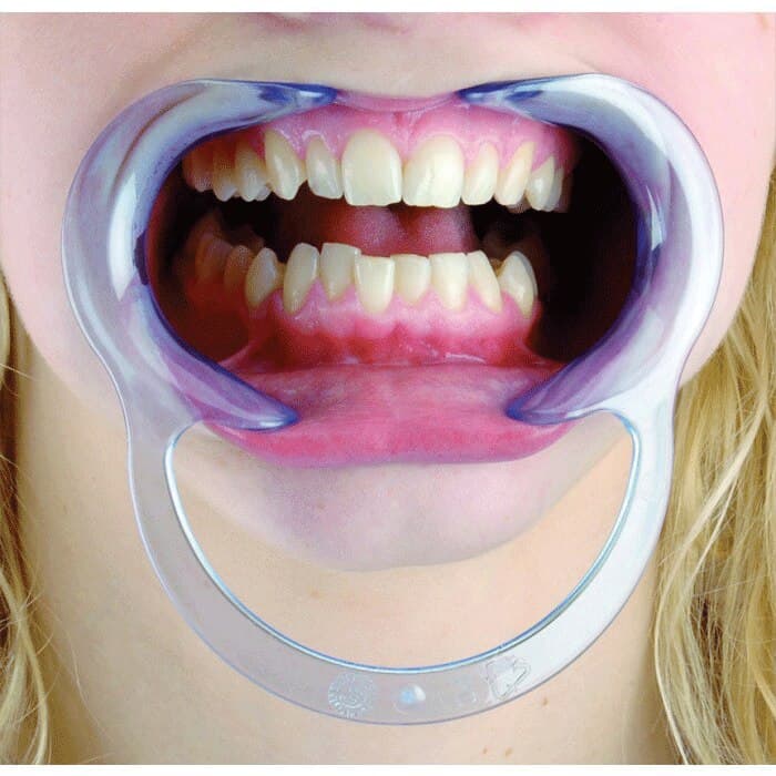Hager Worldwide Spandex Lip & Cheek Retractor, Child, Clear, 2/Pk, 605455 thumbnail 7