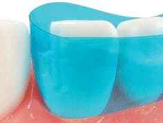 Garrison Dental Blue View VariStrip Contoured Anterior Matrix Strips, 0.0020" Thin, Blue Tint, 100/Pk, VS01 thumbnail 6