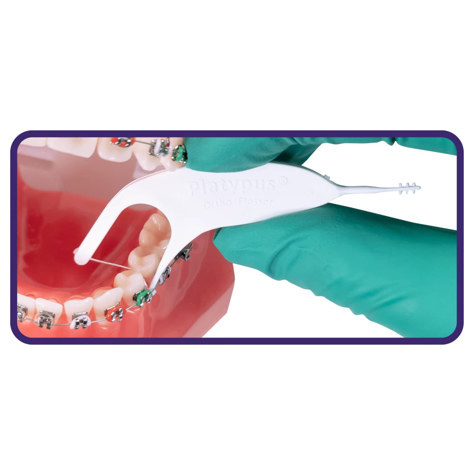 Platypus Orthodontic Flosser Patient Sampler, 75 Packs of 3, 225 Total, T103 thumbnail 6