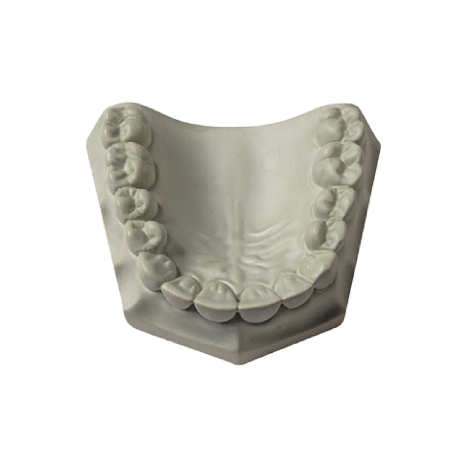 Whip Mix Hard Rock Die Stone, ISO Type 5, Green, 33 lb (15 kg) Carton, #330002 thumbnail 2