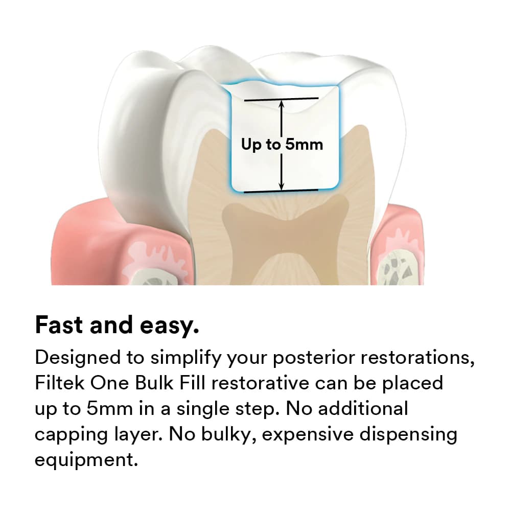 3M Filtek One Bulk Fill Restorative Syringe Refill, 4g, Shade A1, 4866A1 thumbnail 7