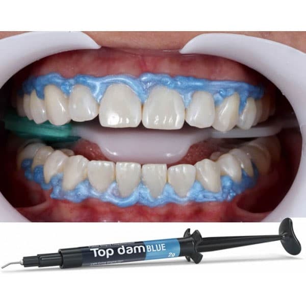 Top Dam Light-Curing Resin Gingival Dam, Blue, 2g Syringe with 3 Applicator Tips - Top dam light-curing resin Gingival Dam, Blue, 1 x 2g Syringe & 3 applicator - Image 1