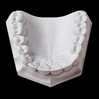 Whip Mix Mounting Plaster, White, Fast Set, ISO Type 1, 33 lb Carton (15 kg), #330090 thumbnail 11
