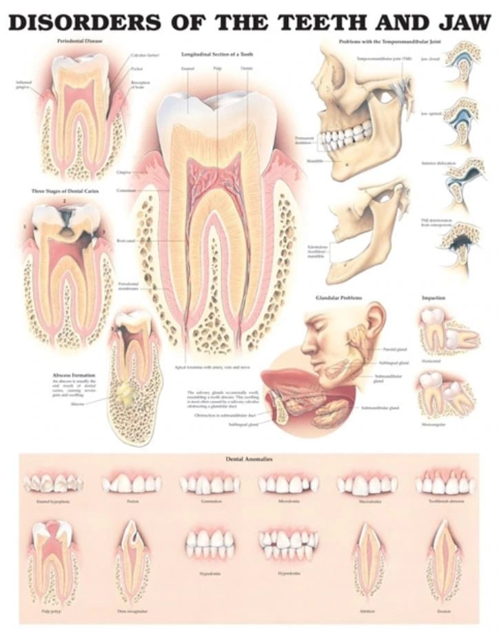 Poster Disorder Of Teeth & Jaw, 20 in x 26 in, Laminated