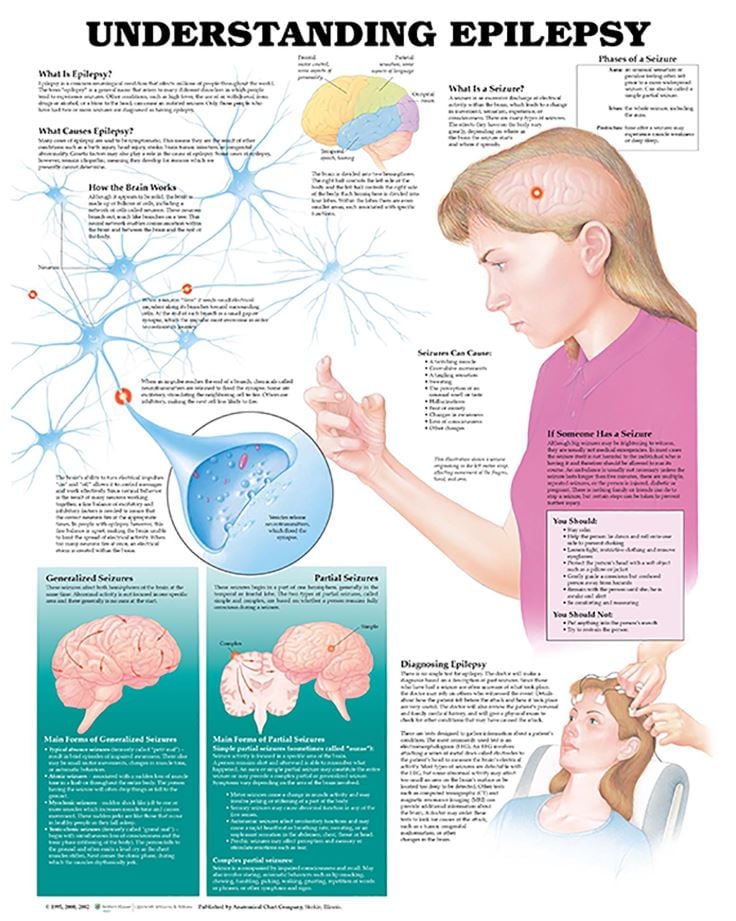 Understanding Epilepsy Educational Chart, 20" x 26", Flexible, Each