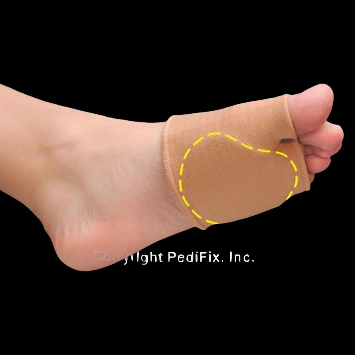 Pedifix Visco-Gel Universal Metal Strap Uncovered Right Foot, Large/X-Large