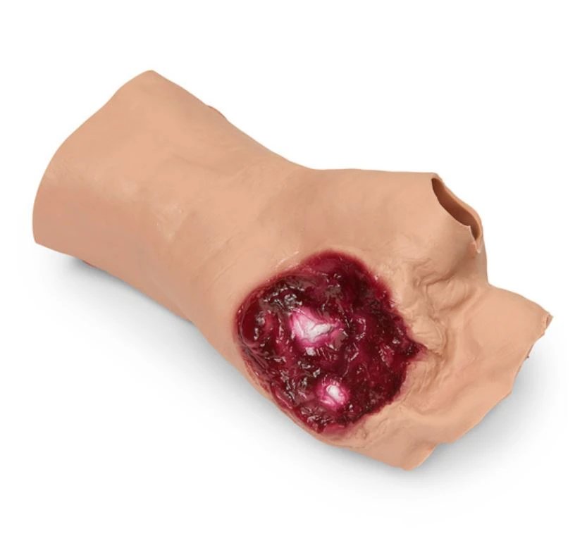 Nasco Healthcare Gunshot Wound Palm Moulage, Training Simulation, Each