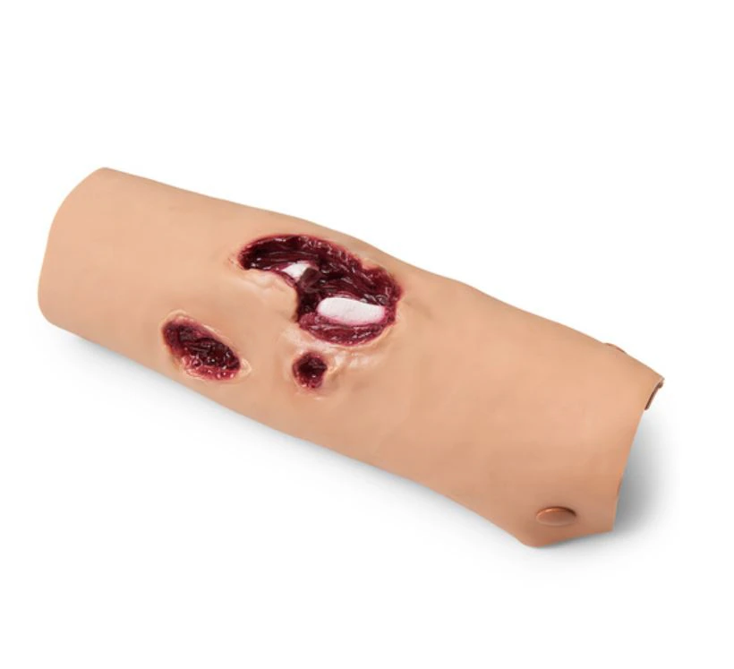 Nasco Healthcare Compound Fracture Tibia Training Moulage