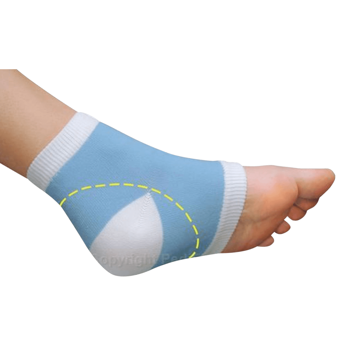 Pedifix Visco-GEL Heel-So-Smooth Sleeve, Heel Gel, One Size