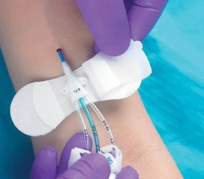 Grip-Lok Tube Securement Device, Medium, 3-1/2" Soft Flexible Fabric, Sterile, Adhesive Back, White, 100/Case
