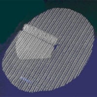 Parietex ProGrip Repair Mesh with Flap, Precut, Right, Polyester (Medtronic)