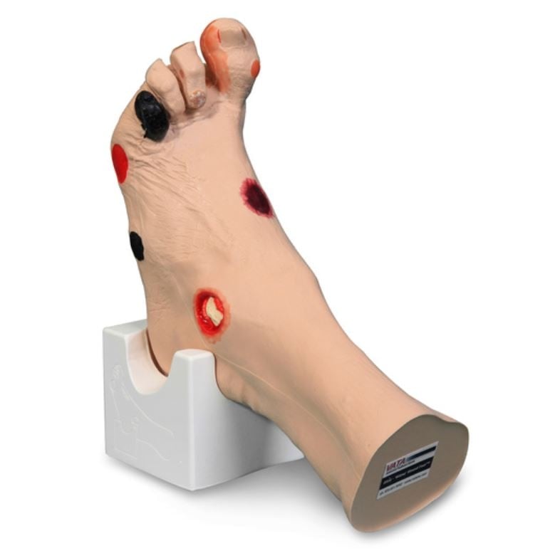 Nasco Healthcare Wilma Wound Foot Anatomical Model, 12-1/2 x 8 x 3-5/8 in