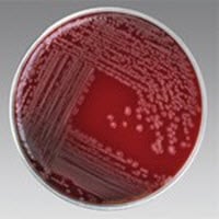 Remel Mueller-Hinton Agar with 5% Sheep Blood, 100mm Plates, 100/Package