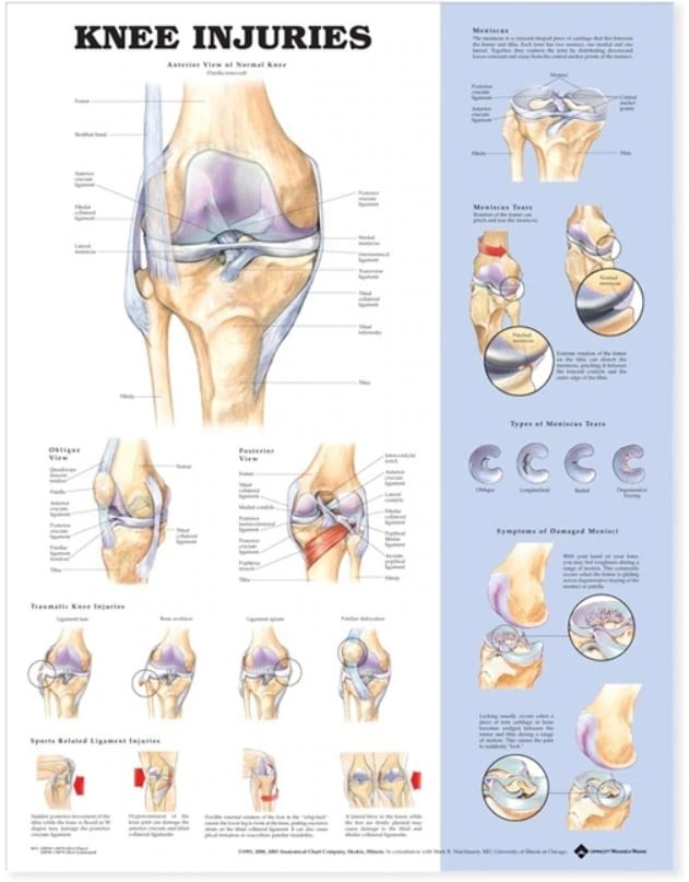 Knee Injuries Anatomical Chart, Mounted, 20" x 26"