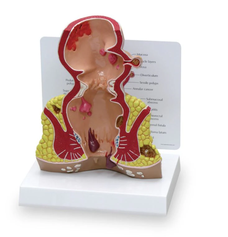 Nasco Healthcare Rectum Anatomical Model, 1-1/2 Life-Size, 5-1/2 x 2-1/2 x 7 inches