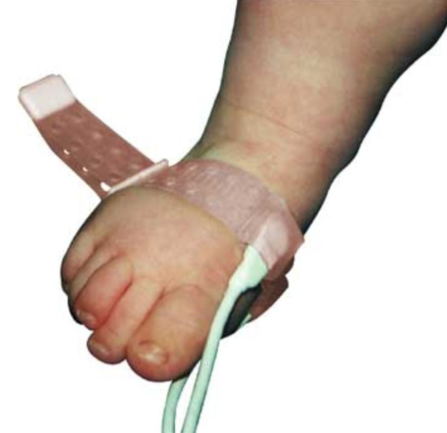 Mediaid Wrap Foot Adjustable Sensor, Pediatric, 6/Package