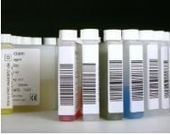 Pointe Scientific Creatinine Reagent 1 & 2 Test Kit for Hitachi, R1: 2L, R2: 500mL, 01KT0J083JBM39H0TK19XPSMA2