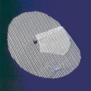 Parietex ProGrip Anatomical Mesh, Right, with Flap