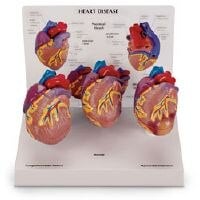 Nasco Healthcare Mini Heart Anatomical Model Set, 3 per Set