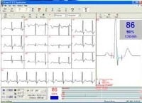 Norav Medical Stress Test Software for Norav 1200 System