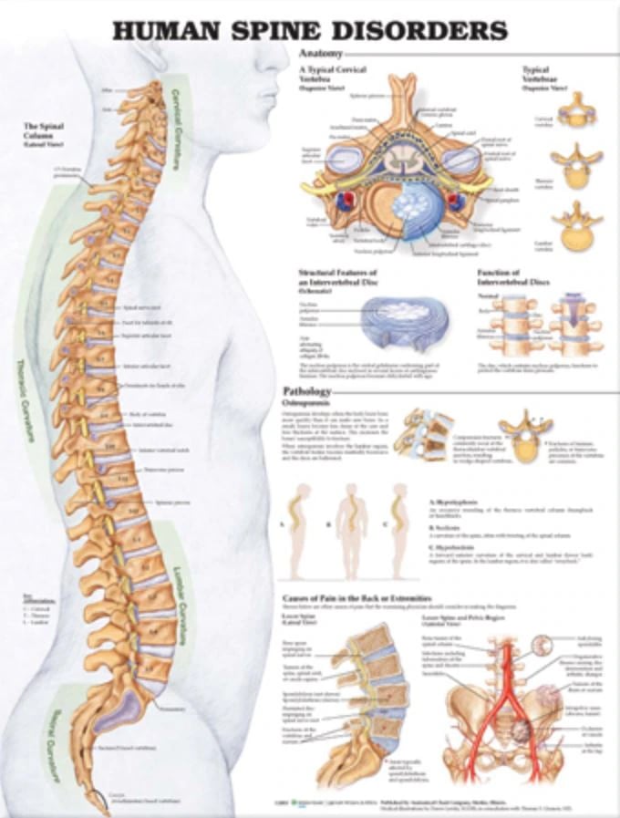 Human Spine Disorders Anatomical Chart, 20" x 26", Each