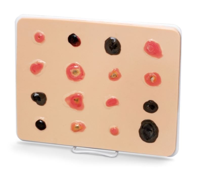 Life/form Enlarged Skin Cancer Educational Trainer, 8-1/2 x 11 x 1/4" with Base, Key Card, Easel, and Storage Box