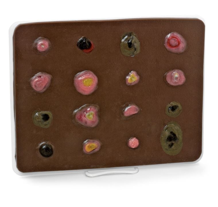 Life/form Enlarged Skin Cancer Educational Trainer, Dark, 8-1/2 x 11 x 1/4 in, with Base, Key Card, Easel, and Storage Box