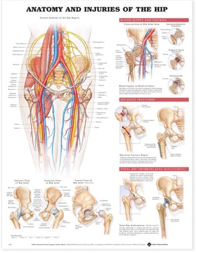 Anatomy & Injuries of the Hip Anatomical Chart, 20" x 26", Each