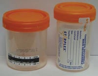 Cup Spec Temp Strip Sterile, 90mL, White O-Ring Cap, Wide Mouth, 400/Case